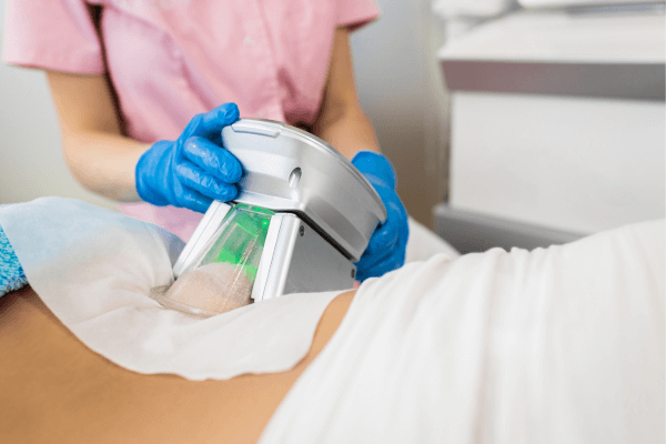 séance-de-cryolipolyse-poignées-d'amour