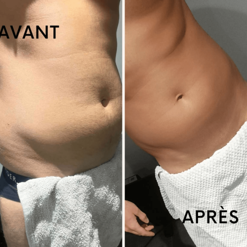 séance-EMS-ventre-résultats-avant-après